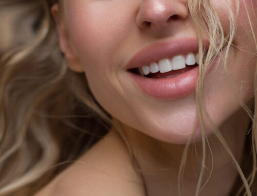 Pełne i podkreślone wargi – powiększanie ust kwasem hialuronowym